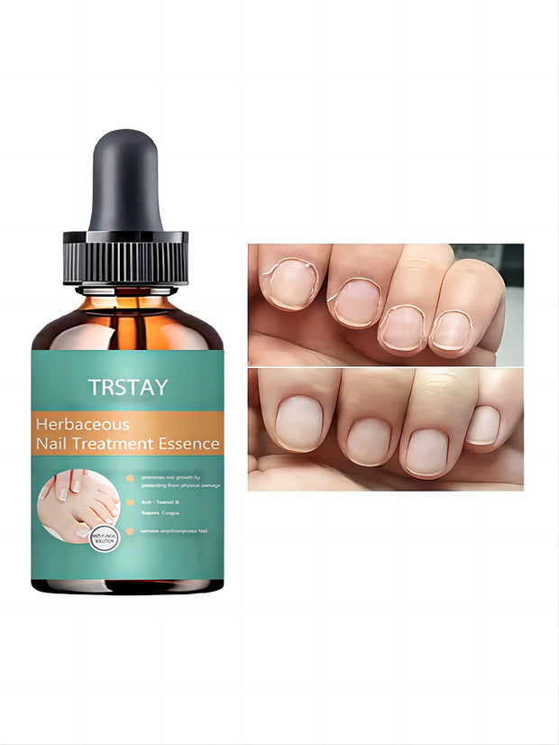 Orange Nail Care Cream, Repair Nails, Keep Nails In Good Condition, Moisturize Nails, And Change The Appearance Of Nails